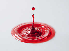 Dana-Farber Cancer Institute unveils groundbreaking blood test for multiple myeloma