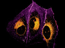 Fat microscopy: Imaging lipids in cells